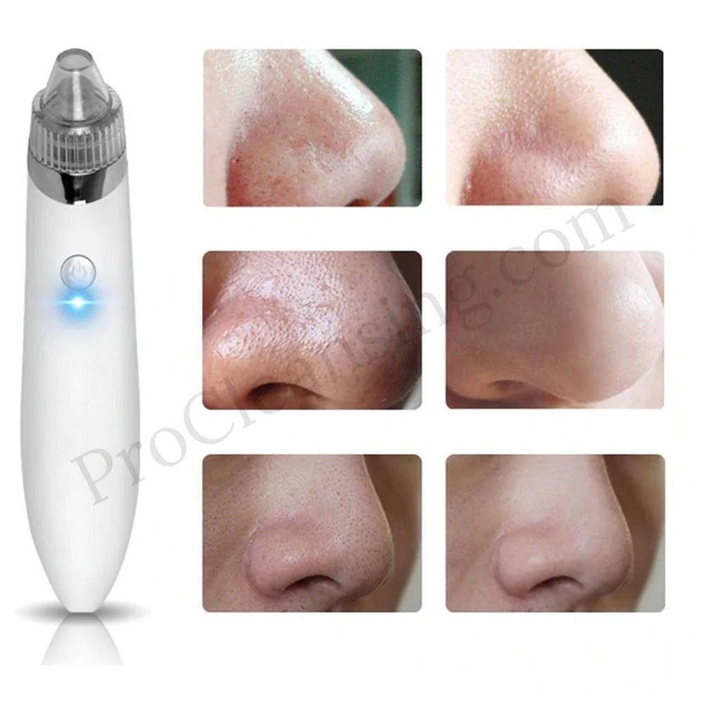 Vacuum Pore Cleaner