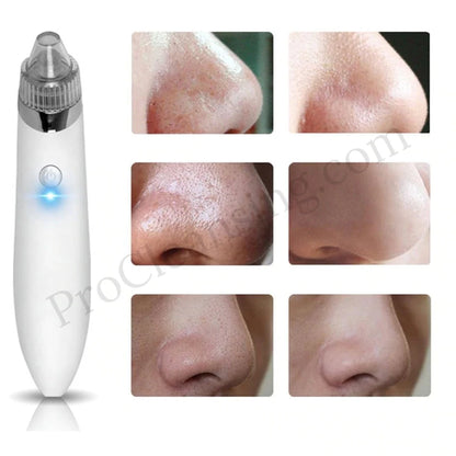 Vacuum Pore Cleaner